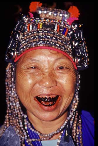 akha with black teeth-AsiaPhotoStock
